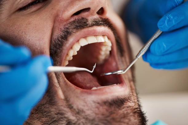 Best Emergency Dentist for Lost Fillings or Crowns in Mammoth Spring, AR